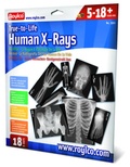 True to Life Human X-Rays